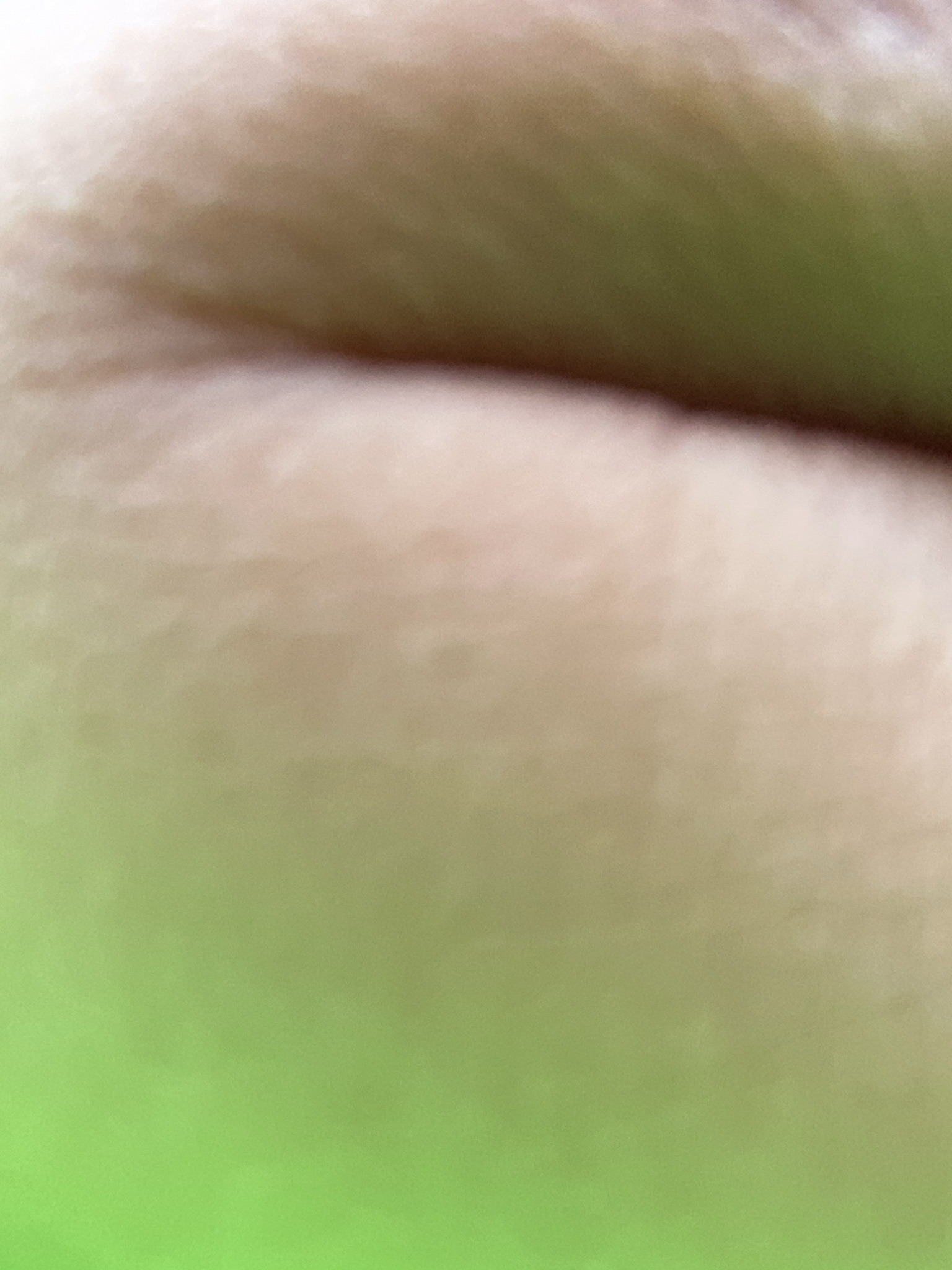 Peach skin surface